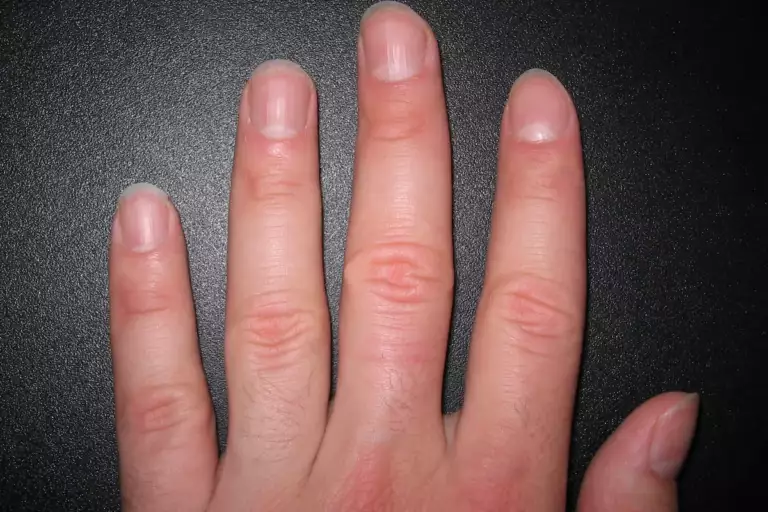 Main posée sur fond sombre, ongles naturels courts, cuticules et replis de peau visibles à la base de chaque ongle.