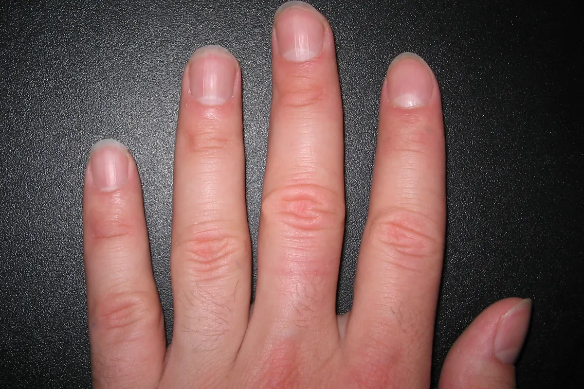Main posée sur fond sombre, ongles naturels courts, cuticules et replis de peau visibles à la base de chaque ongle.